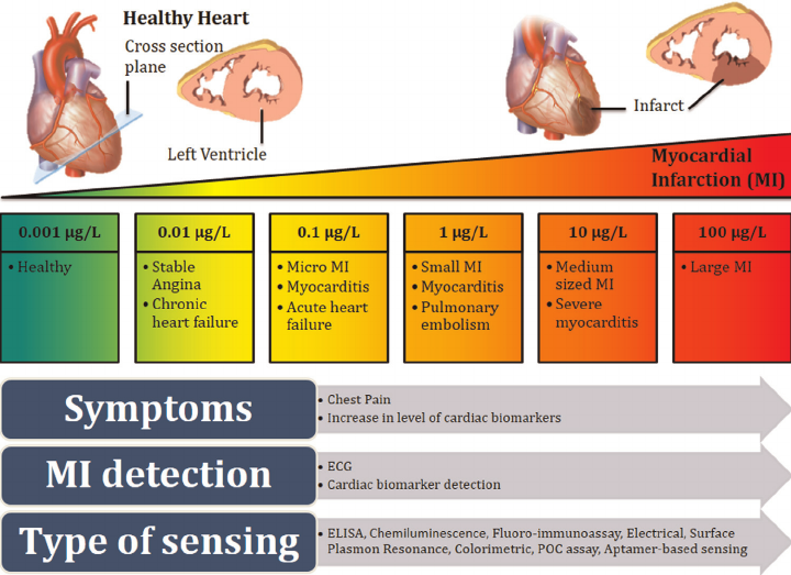ινφ Fig-1-Diagnostics-on-myocινφ ardial-infarction-MI-Troponin-concentration-level